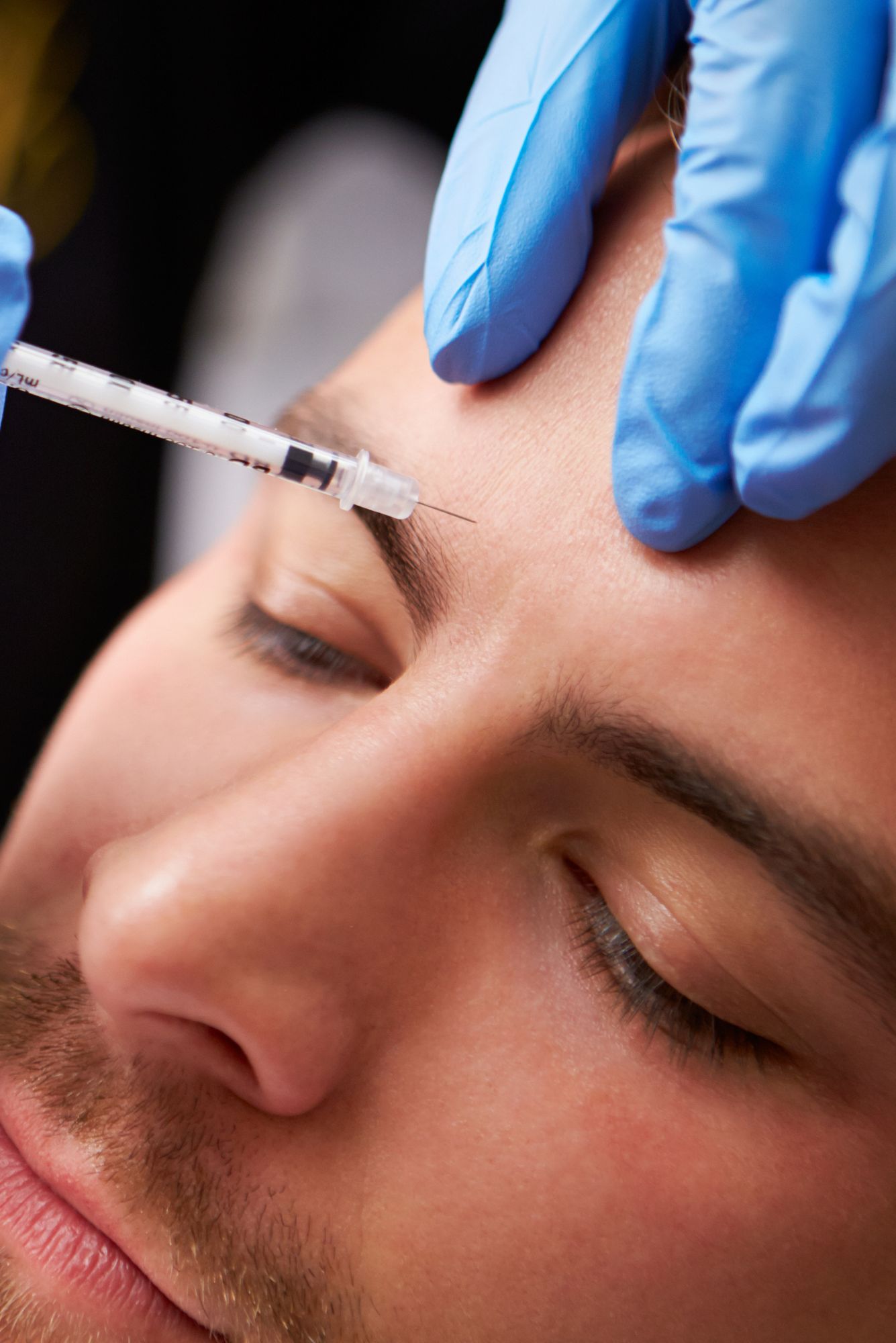 Botox medico esthetique - Clinique dentaire Bourgjoli a Ste-Adele-2